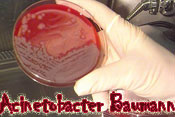 Acinetobacter Baumann has popped up in facilities like Walter Reed Army Medical Center 