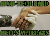 Bionic Technology Changes the Way War Amputees Live