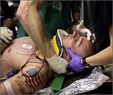 Brain injuries are the Iraq War's signature wound.