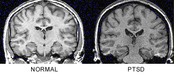 figure1
