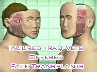 Face transplants offered to wounded Iraq veterans