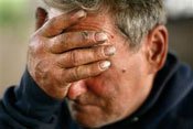 Homeless Vietnam veteran Joseph M. Schlactur holds his brow during an interview in Philadelphia on Oct. 24. 
