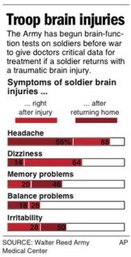 tbi
