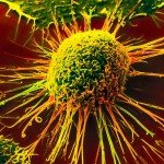 Cancer cell