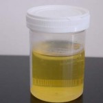 Image Commons Wikimedia org pee-piss-urine