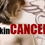 skin-cancer