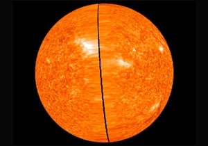 Global Warming Causing Kidney Stones — Especially in Men