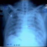 Rabin Xray