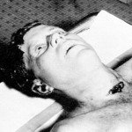 JFK-AUTOPSY