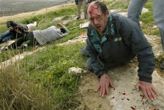 Shanbo Heinemann, a pro-Palestinian activist from San Francisco, California, was shot in the head with a rubber bullet fired by Israeli forces during a protest in Bil’in.