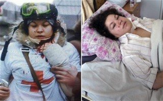 brave Olesya-Zhukorska recovers from sniper shot to neck