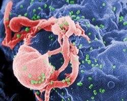 HIV - in its budding state