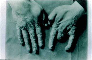 Madame Curies' Hands