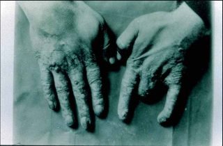 Madame Curies' Hands