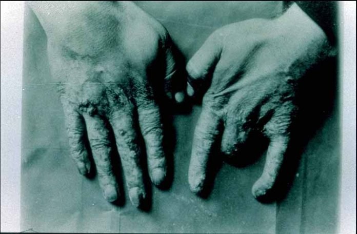 Madame Curies' Hands