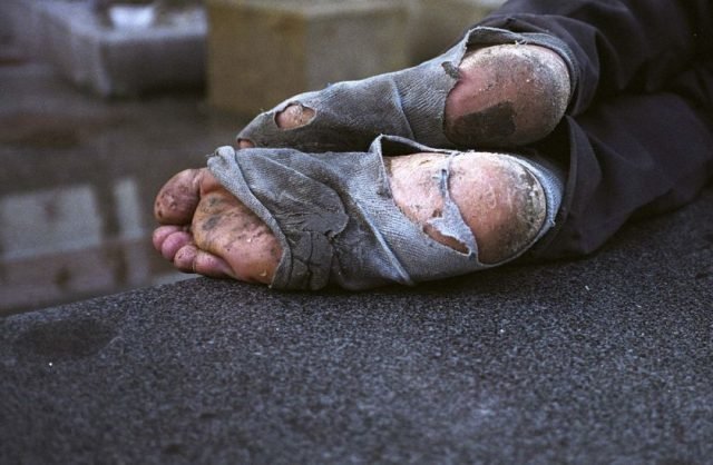 homeless