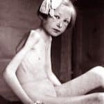 starvation-in-1945-Germany_489
