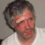Silverrman_beat-up_2-e1386208448521