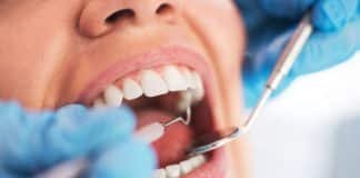 Different Types Of Dental Fillings